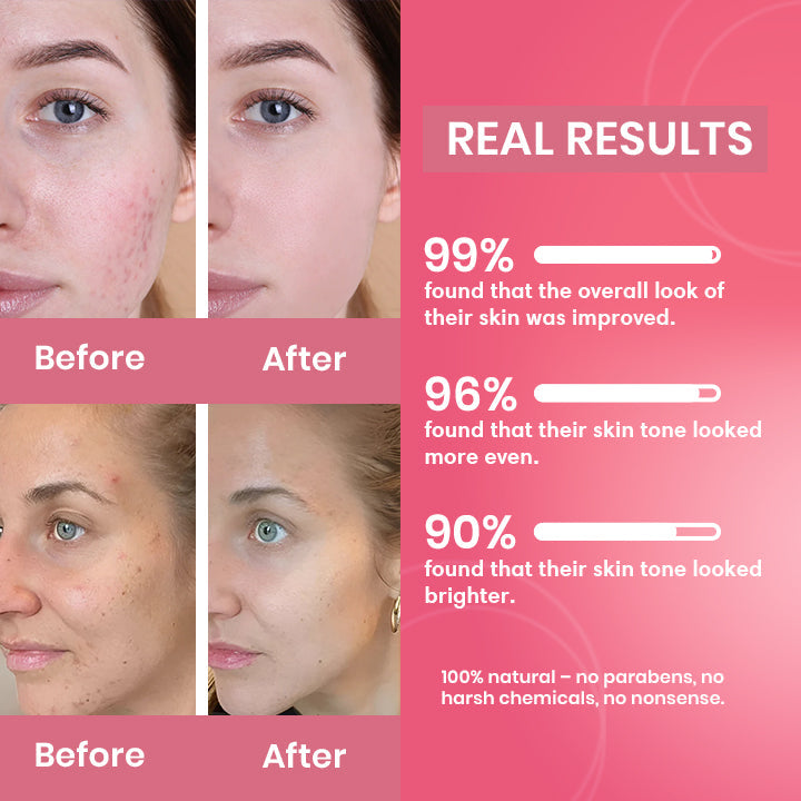 Turmeric Kojic Acid Exfoliating Cleansing Pads